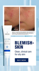 IMAGE Skincare Acne Spot Treatment – 2% Salicylic Acid Blemish Fighter